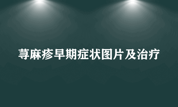 荨麻疹早期症状图片及治疗