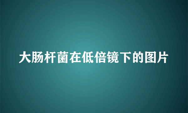 大肠杆菌在低倍镜下的图片