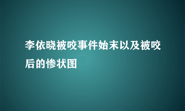 李依晓被咬事件始末以及被咬后的惨状图