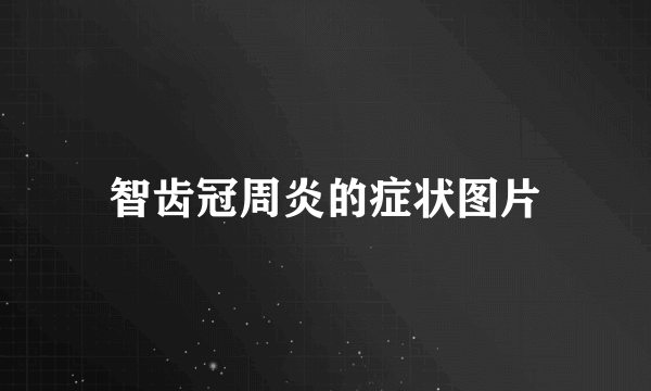 智齿冠周炎的症状图片