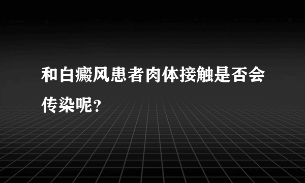 和白癜风患者肉体接触是否会传染呢？