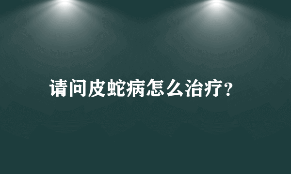 请问皮蛇病怎么治疗？