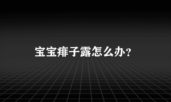 宝宝痱子露怎么办？