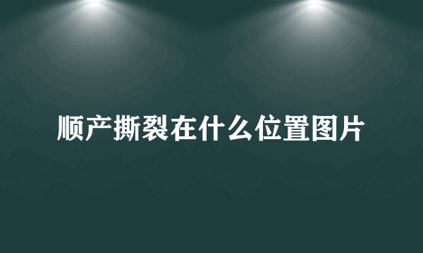 顺产撕裂在什么位置图片