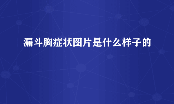 漏斗胸症状图片是什么样子的