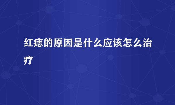 红痣的原因是什么应该怎么治疗