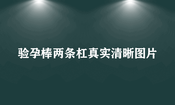 验孕棒两条杠真实清晰图片