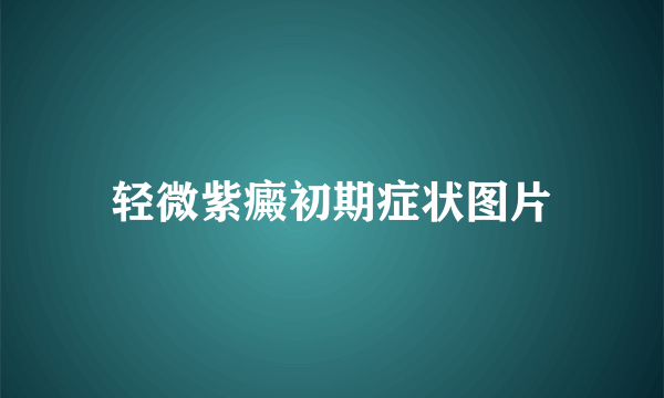 轻微紫癜初期症状图片