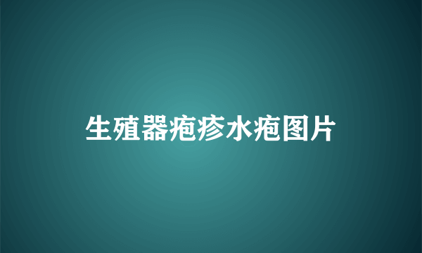 生殖器疱疹水疱图片