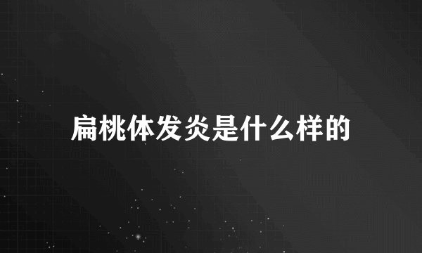 扁桃体发炎是什么样的