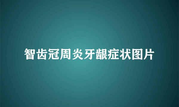 智齿冠周炎牙龈症状图片