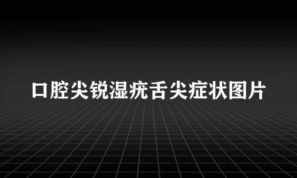 口腔尖锐湿疣舌尖症状图片