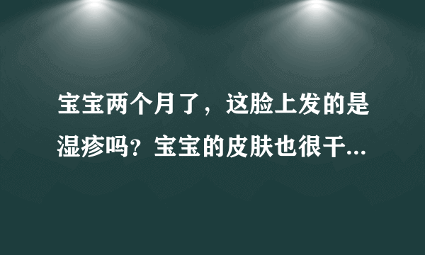 宝宝两个月了，这脸上发的是湿疹吗？宝宝的皮肤也很干还有脱皮了，怎么办？急死了