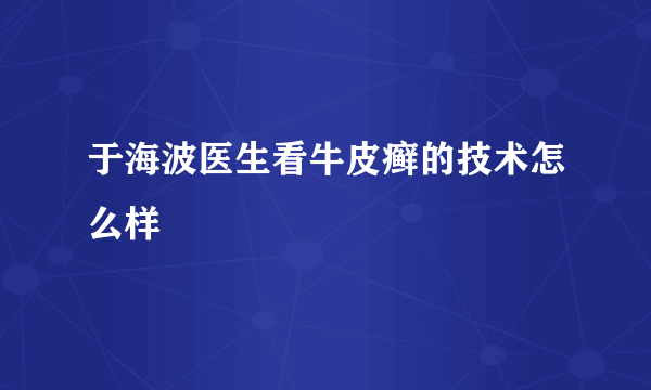 于海波医生看牛皮癣的技术怎么样