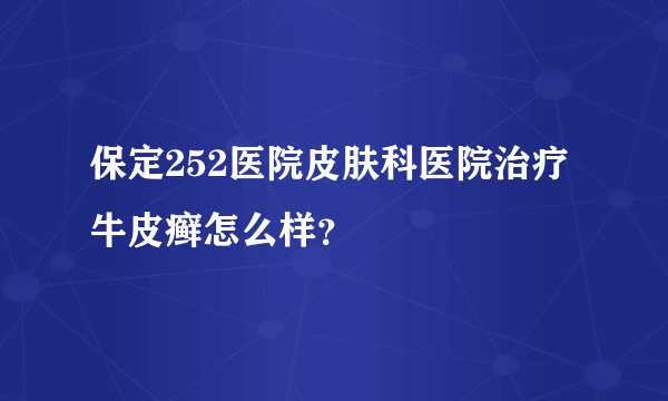 保定252医院皮肤科医院治疗牛皮癣怎么样？