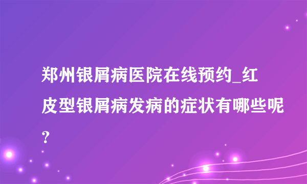 郑州银屑病医院在线预约_红皮型银屑病发病的症状有哪些呢？