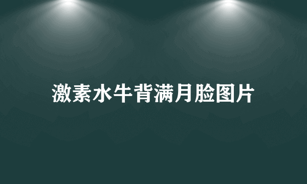 激素水牛背满月脸图片