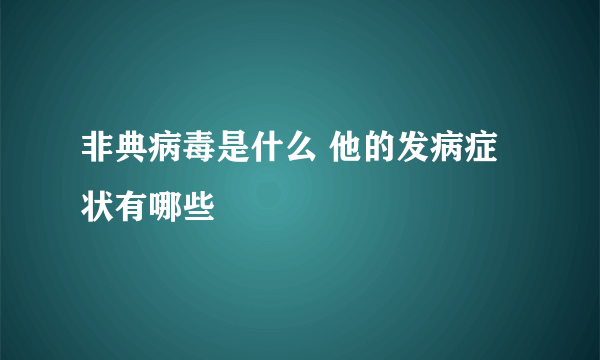 非典病毒是什么 他的发病症状有哪些