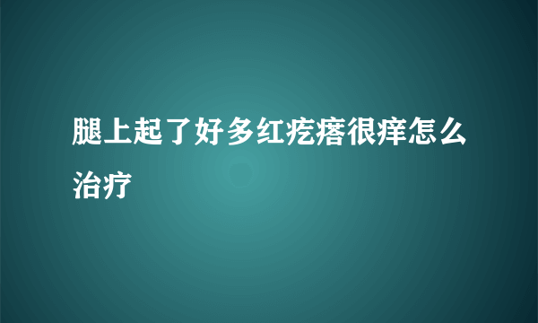 腿上起了好多红疙瘩很痒怎么治疗