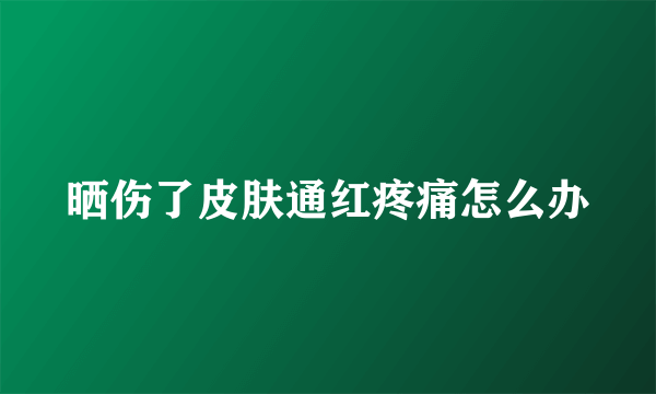 晒伤了皮肤通红疼痛怎么办