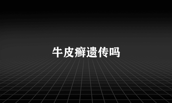 牛皮癣遗传吗