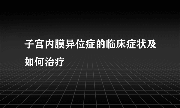 子宫内膜异位症的临床症状及如何治疗