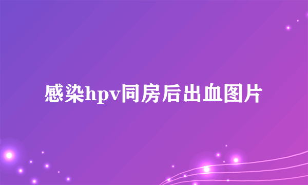 感染hpv同房后出血图片