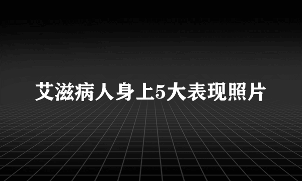 艾滋病人身上5大表现照片