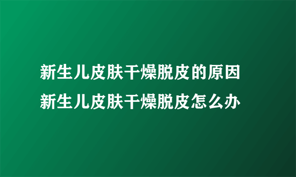 新生儿皮肤干燥脱皮的原因 新生儿皮肤干燥脱皮怎么办