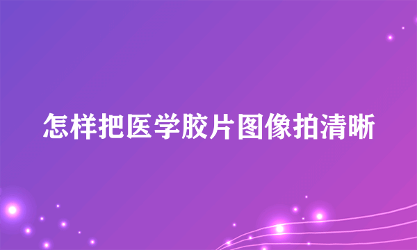 怎样把医学胶片图像拍清晰