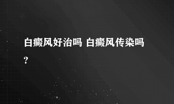 白癜风好治吗 白癜风传染吗？