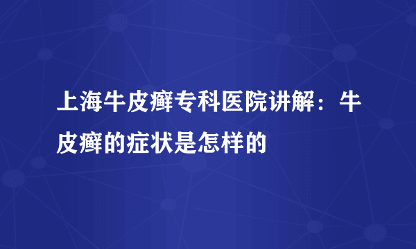 上海牛皮癣专科医院讲解：牛皮癣的症状是怎样的