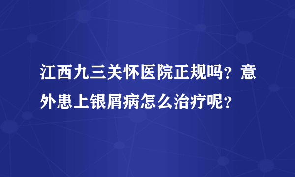 江西九三关怀医院正规吗？意外患上银屑病怎么治疗呢？