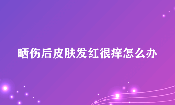 晒伤后皮肤发红很痒怎么办