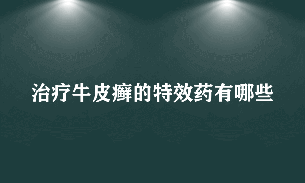 治疗牛皮癣的特效药有哪些