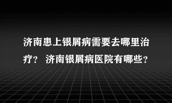 济南患上银屑病需要去哪里治疗？ 济南银屑病医院有哪些？