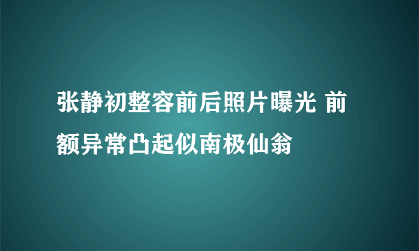 张静初整容前后照片曝光 前额异常凸起似南极仙翁