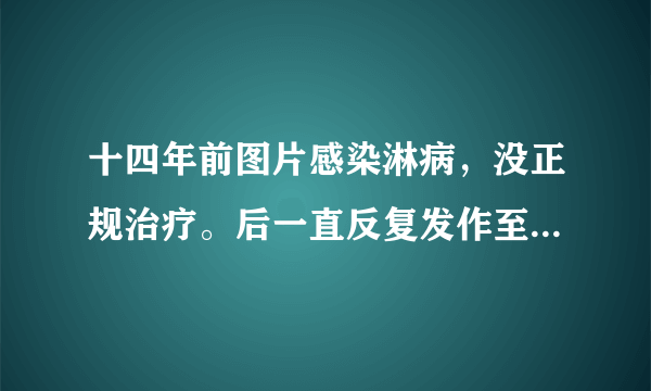 十四年前图片感染淋病，没正规治疗。后一直反复发作至...