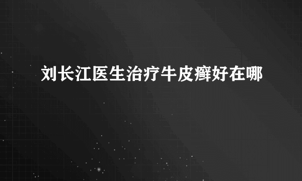 刘长江医生治疗牛皮癣好在哪