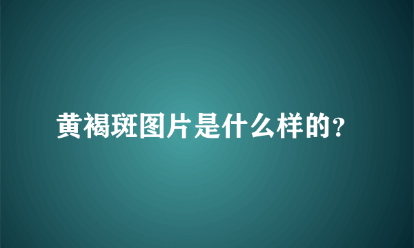 黄褐斑图片是什么样的？