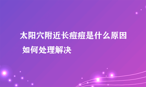 太阳穴附近长痘痘是什么原因 如何处理解决