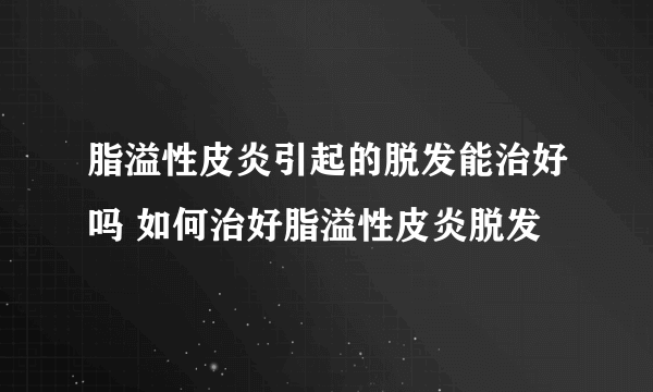 脂溢性皮炎引起的脱发能治好吗 如何治好脂溢性皮炎脱发