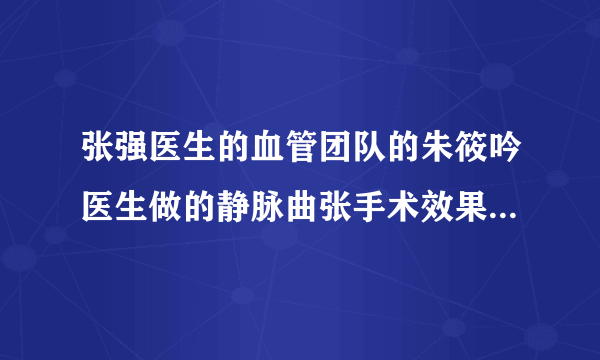 张强医生的血管团队的朱筱吟医生做的静脉曲张手术效果如何？做完就不会复发吗？