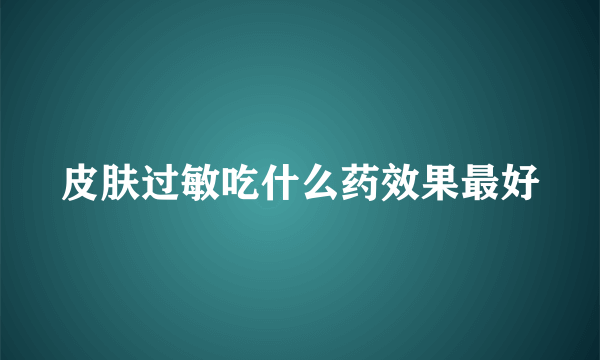 皮肤过敏吃什么药效果最好