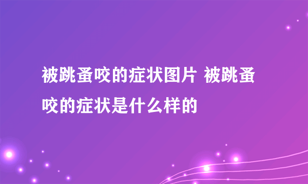 被跳蚤咬的症状图片 被跳蚤咬的症状是什么样的