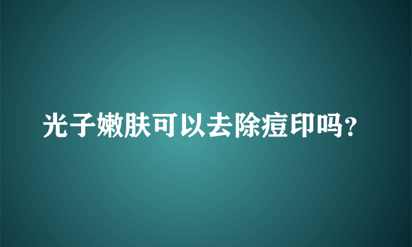 光子嫩肤可以去除痘印吗？