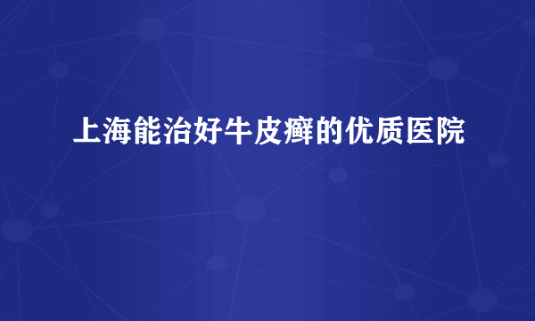 上海能治好牛皮癣的优质医院