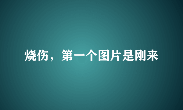 烧伤，第一个图片是刚来