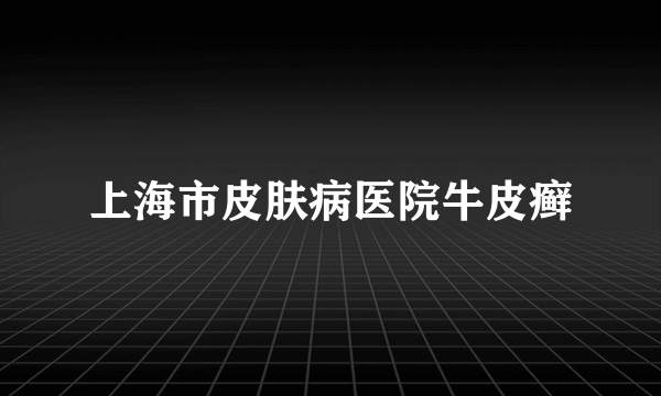 上海市皮肤病医院牛皮癣