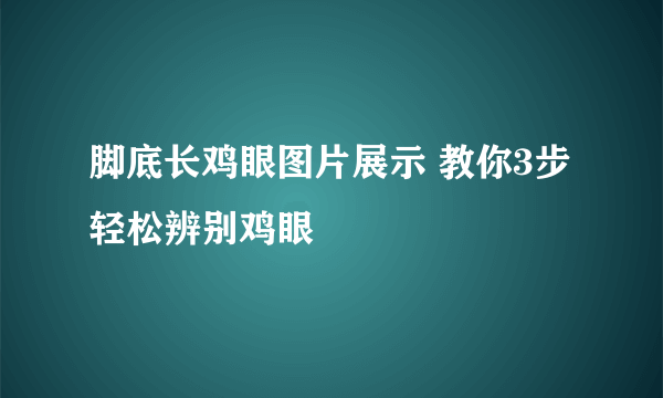 脚底长鸡眼图片展示 教你3步轻松辨别鸡眼